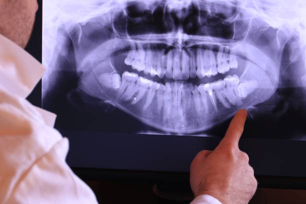 Best Emergency Dental Services for Seniors in Orida City, FL